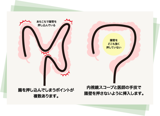 熟練した内視鏡挿入技術